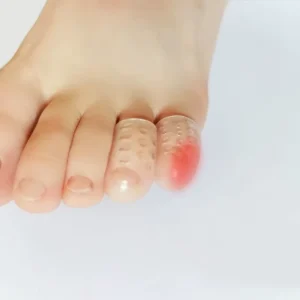 20pcs Durable Silicone Toe Protector Sleeves for High Heels Skin Friendly Lightweight Breathable Comfortable Foot