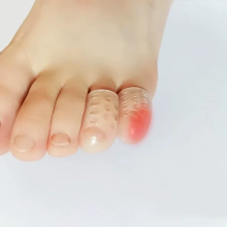 20pcs-Durable-Silicone-Toe-Protector-Sleeves-for-High-Heels-Skin-Friendly-Lightweight-Breathable-Comfortable-Foot